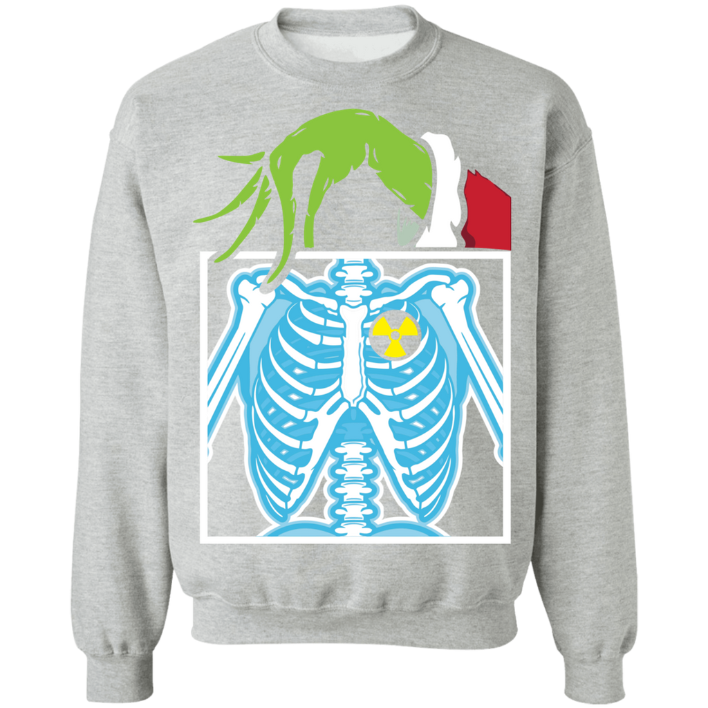 Who Stole Radiology X-ray Ugly Christmas Sweatshirt Adult Unisex
